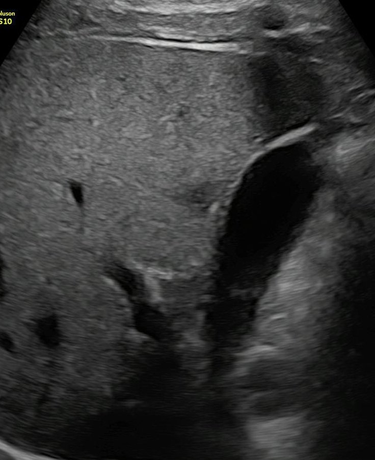 Imagen de una ecografía abdominal realizada en el centro